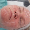 Image 4: Lift and Tone with Advanced HIFU for Face With or Without Neck