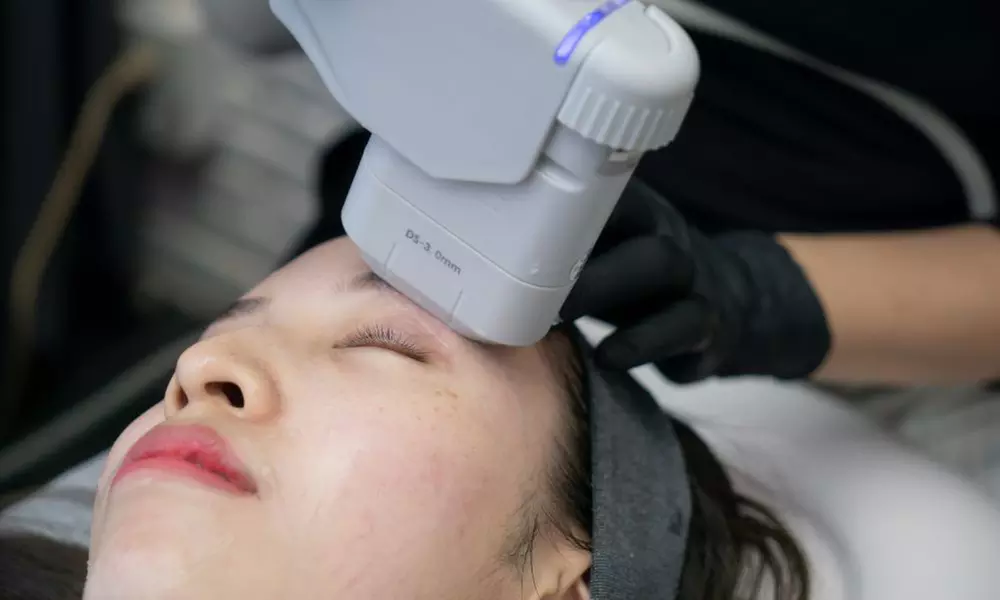 5D Hifu Treatment at Miami Kiss