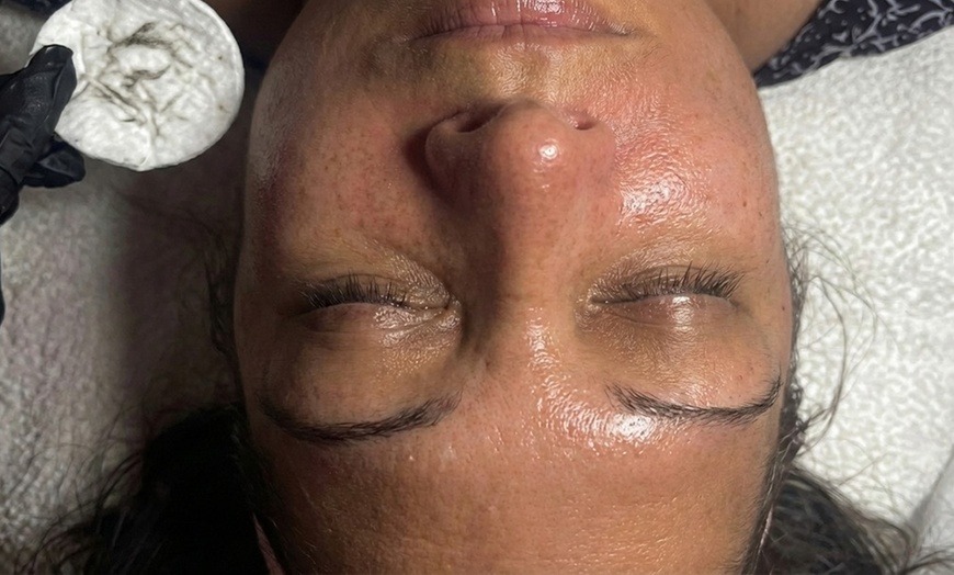 Image 4: 1, 2, or 3 Facials or Upgrade to Dermaplaning/Microdermabrasion