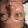 Image 4: 1, 2, or 3 Facials or Upgrade to Dermaplaning/Microdermabrasion