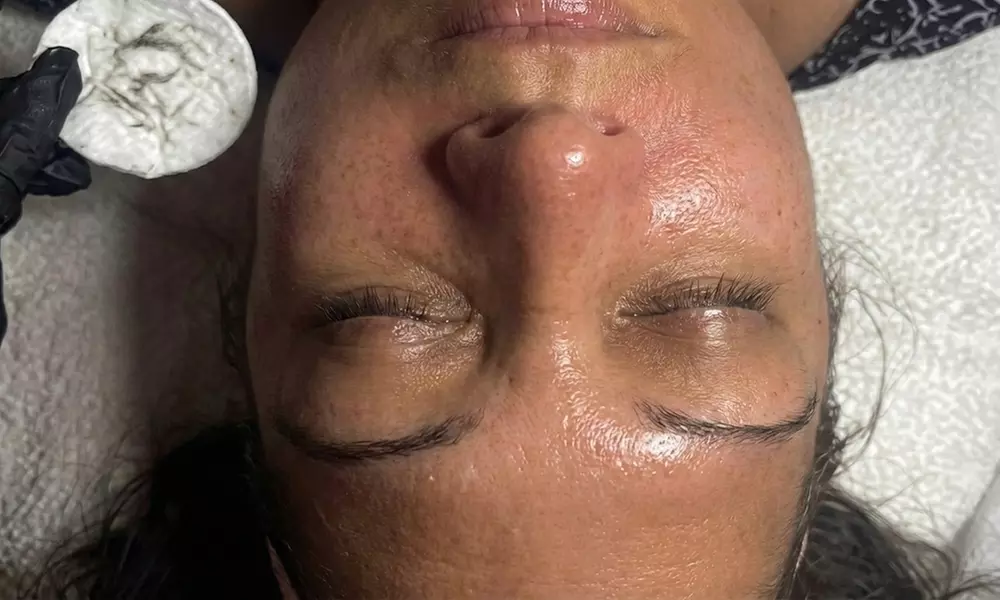 1, 2, or 3 Facials or Upgrade to Dermaplaning/Microdermabrasion