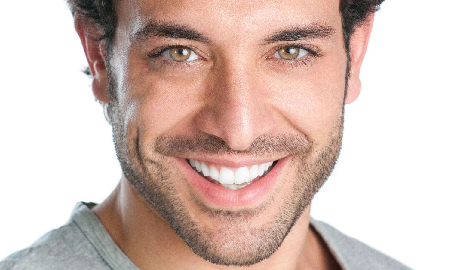 Brackets metálicos o estéticos hasta -90%