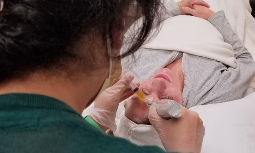 Image 1: Up To 50% Off  1 or 2 Microneedling Treatments + Hyaluronic Acid Serum at Ethreal Rejuvenation Mercer Island
