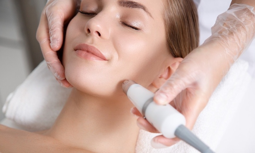 Image 3: Peel or Microneedling