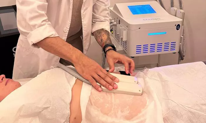 Define tus curvas con 1 o 2 sesiones de criolipólisis y EMSculpt