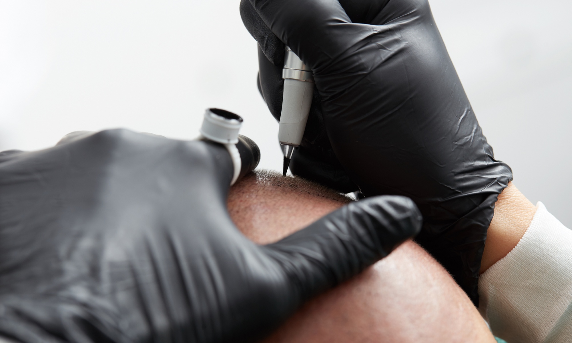 Scalp Micro Pigmentation behandeling voor 1 of 2 zones