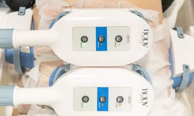 1 séance de cryolipolyse sur 1, 2 ou 3 zones au choix