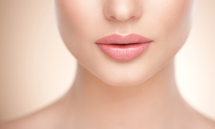 Image 1: Restore Lost Volume with Lip or Cheek Volume Enhancement