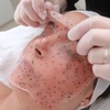 Image 3: Lymphatic Drainage or Hydro Peel Facial with Oxygen Therapy and More