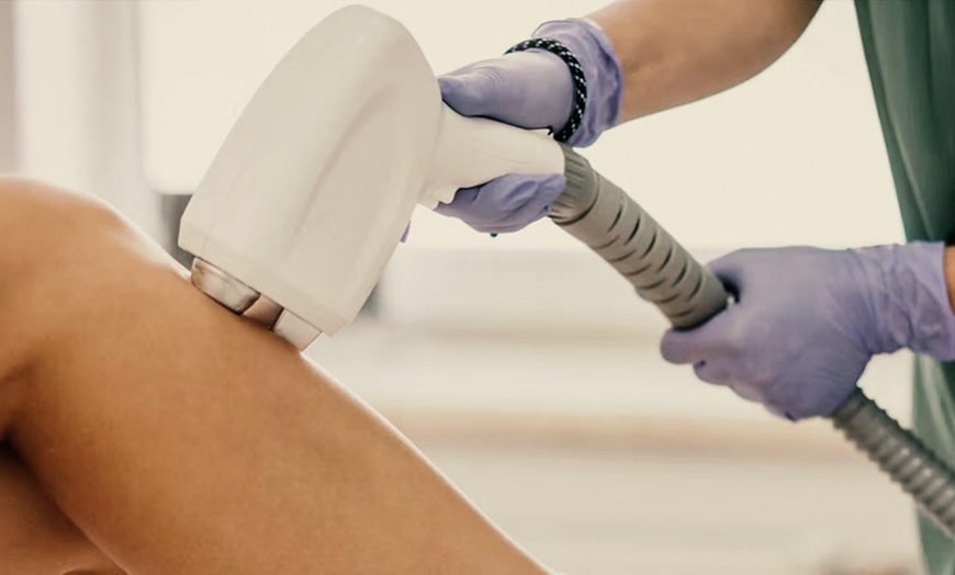 Image 1: Smooth Skin with One IPL Hair Removal Session on One XLarge Area