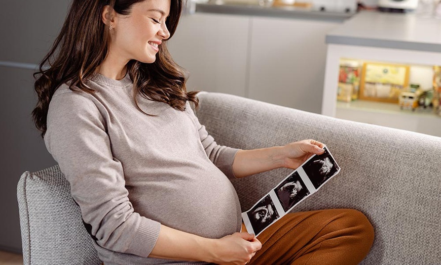 Image 3: Up to 25% Off on Ultrasound - 3D / 4D at Numi Scan Derby