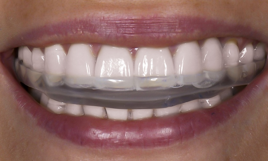 Image 2: Ferula de descarga Michigan para tratar el bruxismo para 1 persona 