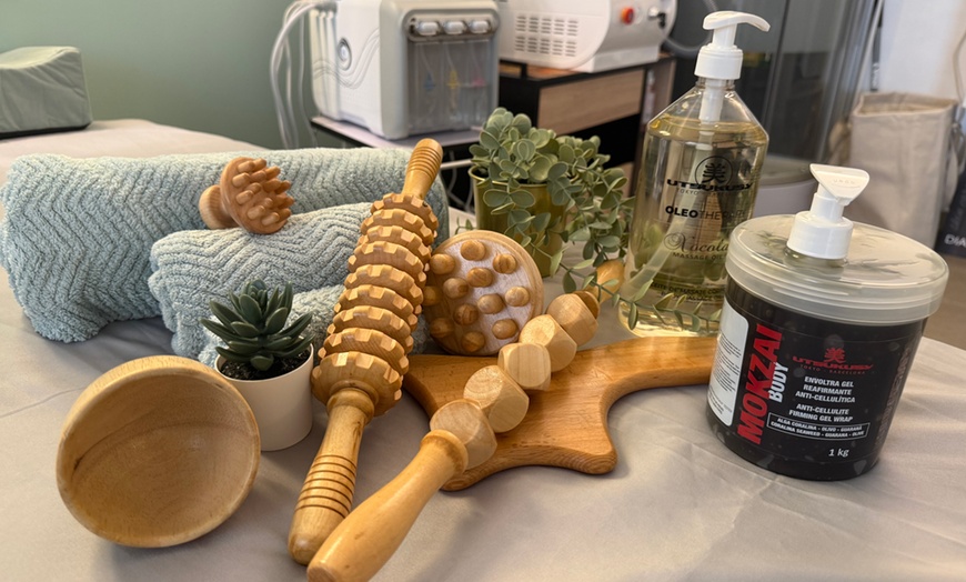 Image 8: 1 o 2 sesiones de radiofrecuencia facial