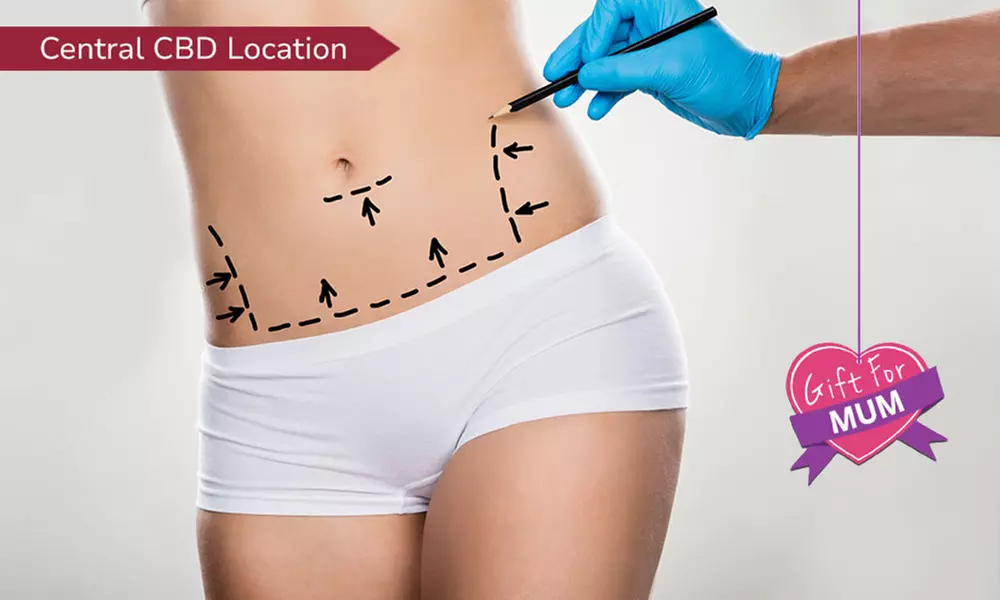 Up to 81% Off on Ultrasonic Fat Reduction at La Belle Beauty and Laser Clinic
