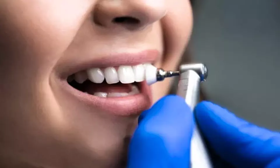 1 o 2 limpiezas dentales completas con diagnóstico