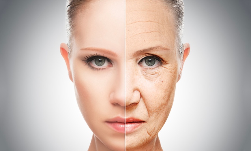 Image 2: One Radiofrequency Thermalift Skin Tightening Face and LED Treatment
