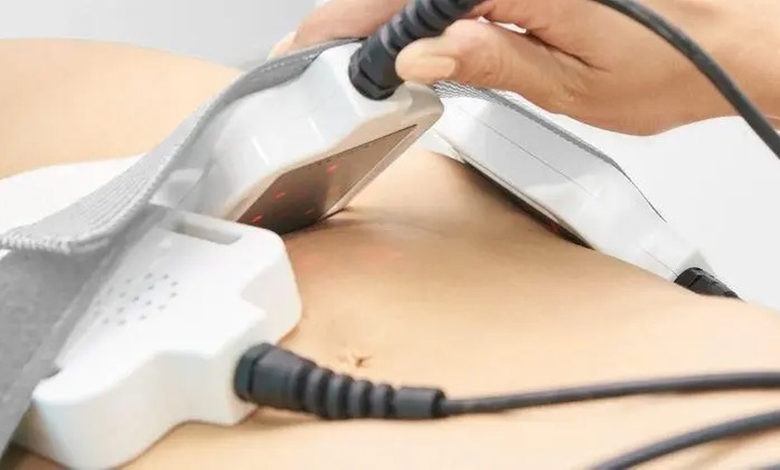 Image 4: Get 2, 4, 6, or 10 Non-Invasive Laser Lipo Treatments for Better Shape