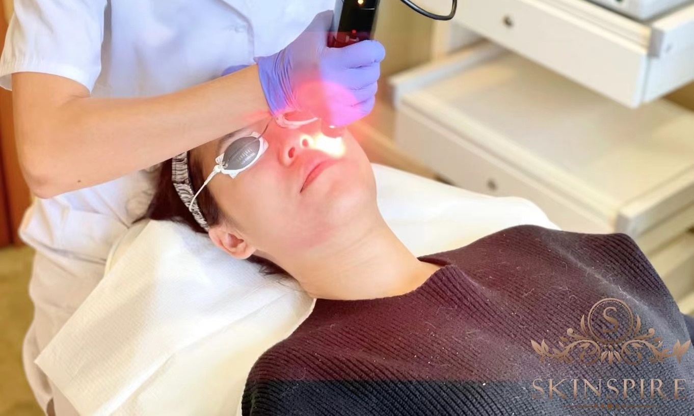 Up to 55% Off on Laser Skin Resurfacing-Unbranded at Skinspire Laser And Skin Clinic 久时美黛医美中心