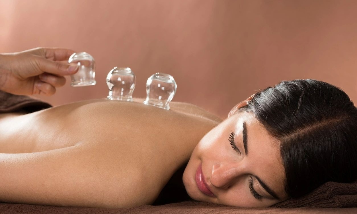 Holistic Healing: Therapeutic Acupuncture or Cupping with Consultation
