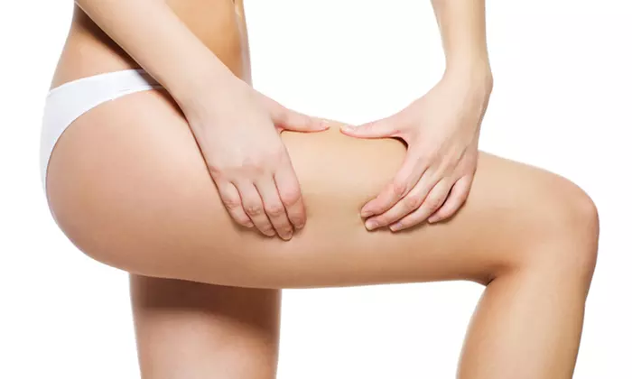 Six, Nine, or 12 Cellulite-Reduction Treatments at Cellulite Free for Life (Up to 63% Off) - Primary Image