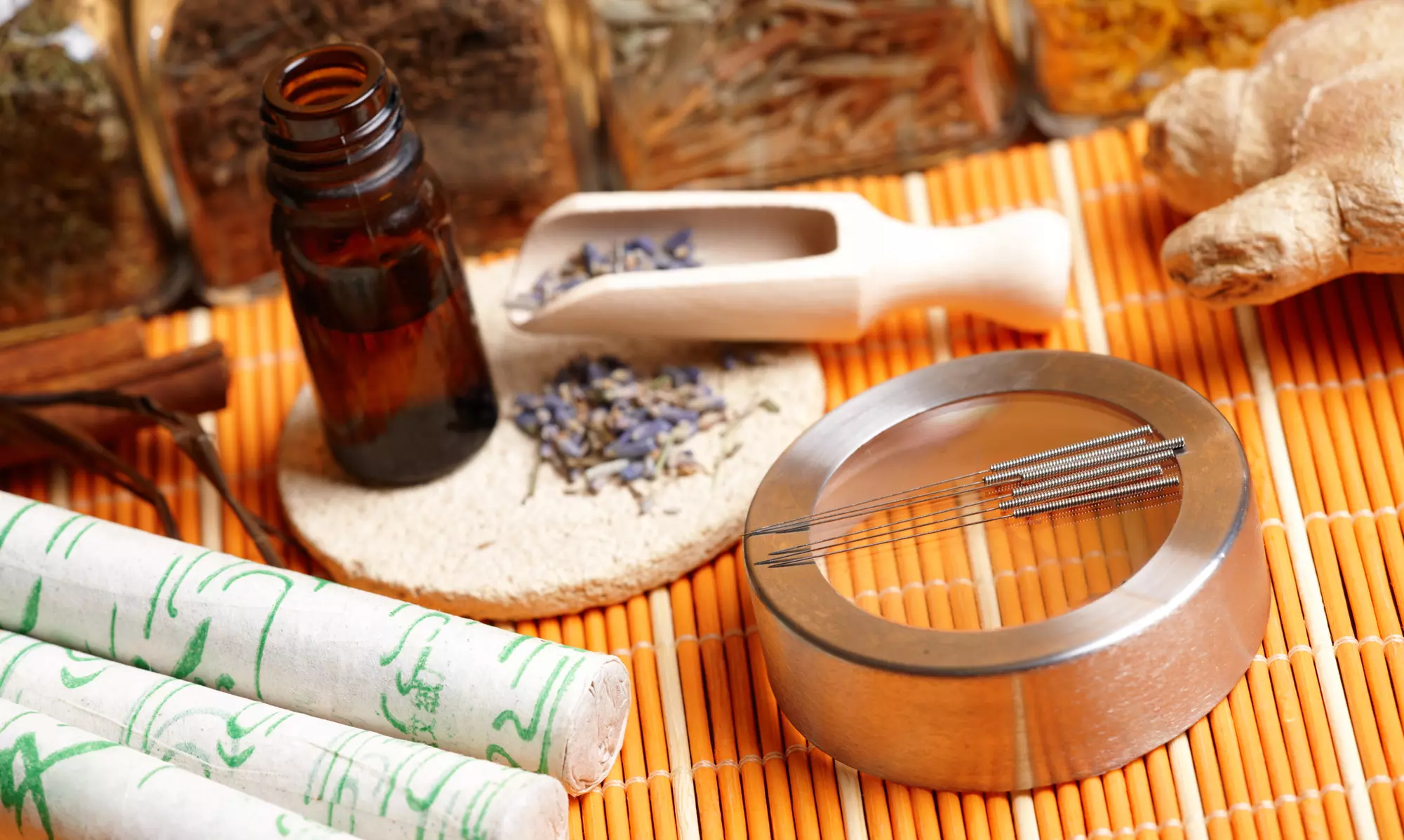 One or Two Acupuncture Treatments at John & Jenny Traditional Chinese Medicine Clinic Center (Up to 80% Off) - Primary Image