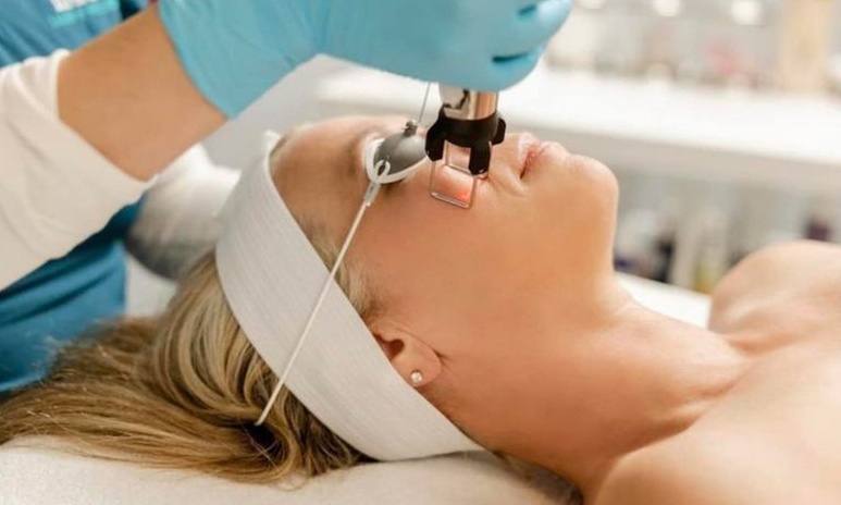 One or Three Cool Peels at 24Karat Glo Medical Aesthetics