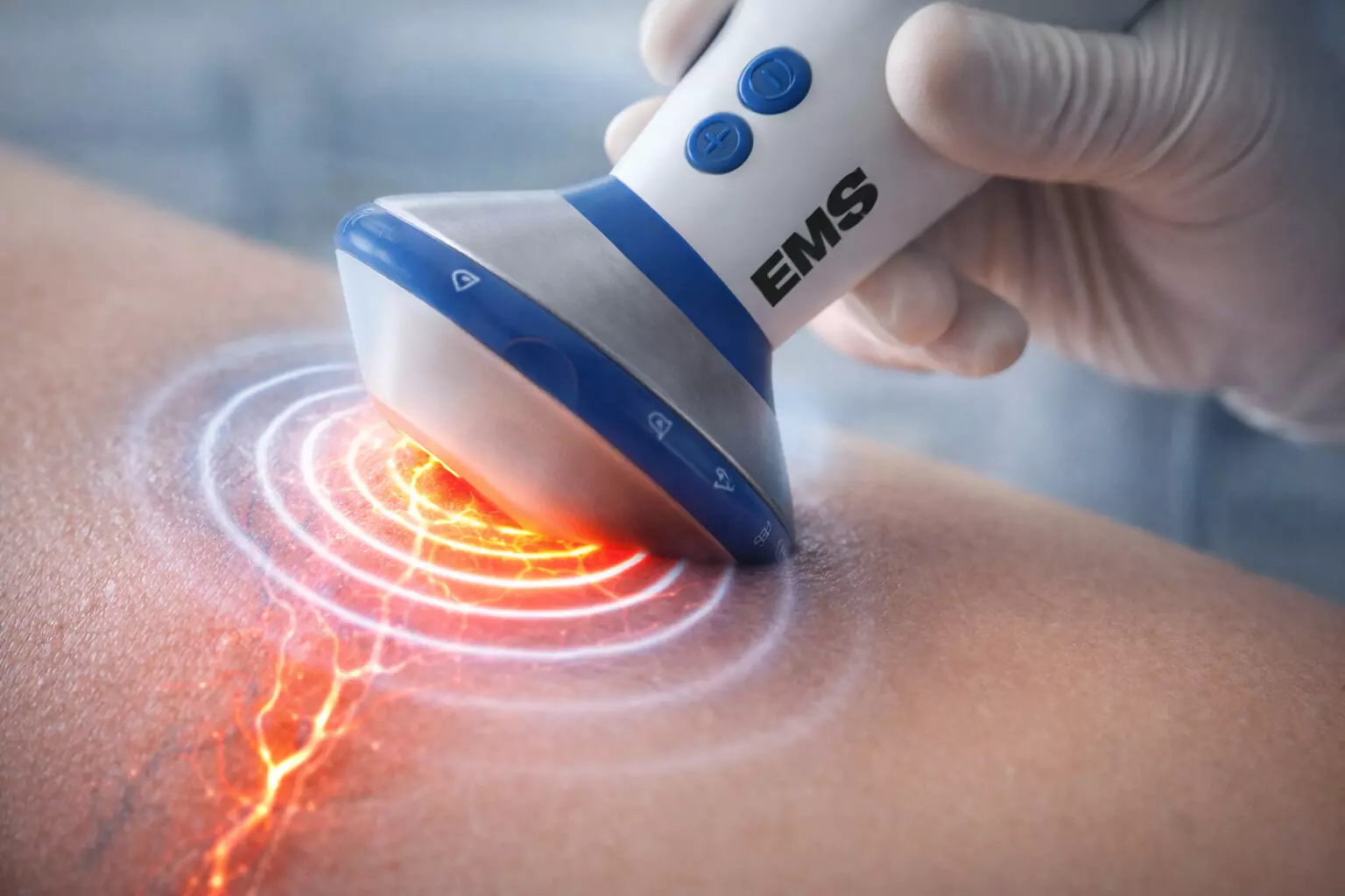 Find Targeted Relief: Consultation + 1 or 3 Shockwave Therapy Sessions (30 Min Each) (Up to 97% Off) - Primary Image