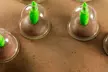 Therapeutic 12-Cup Vacuum Cupping Set with Suction Pump - Second Medium