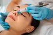 Soin du visage avec Soins Privés : microneedling de 40 min ou Hydraclean d'1h (jusqu'à 45% de remise) - Second Medium