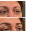 Image 4: Eyebrow Microblading and Touch-Up for Perfect Brows