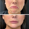 Image 6: Youthful Confidence Awaits with 20, 40, or 60 Units of Botox Treatment