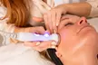 Revitaliza tu rostro: limpieza facial a elegir con tratamientos adicionales para 1 persona, ahorra hasta un 63% - Image 4