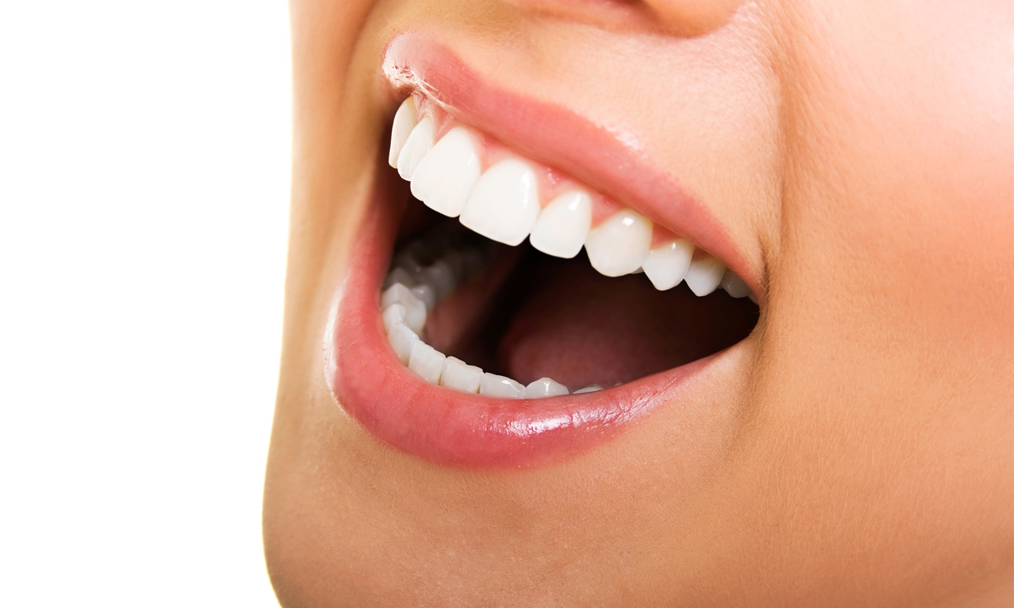 Brighten Your Smile with One or Two Teeth Whitening Treatments