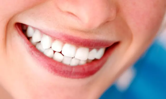 $99 for One 60-Minute Zoom! Teeth Whitening Session at Adrenity Body & Glow Studio ($150 Value) - Primary Image
