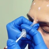 Image 4: Up to 46% Off on Injection - Botox at VEDA Aesthetic Healthcare