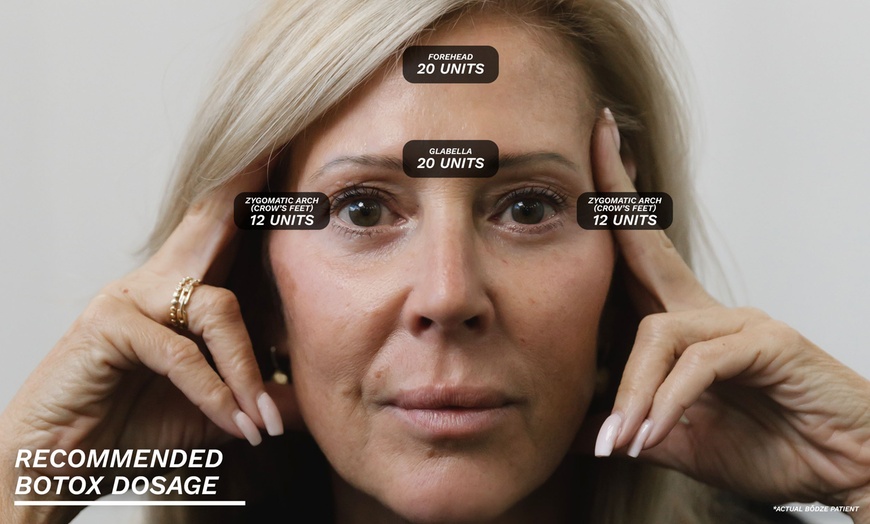 Image 2: Get a Youthful Glow with 20, 40, or 60 Units of Botox at Renowned bŏdze Wellness Center (30% Off)