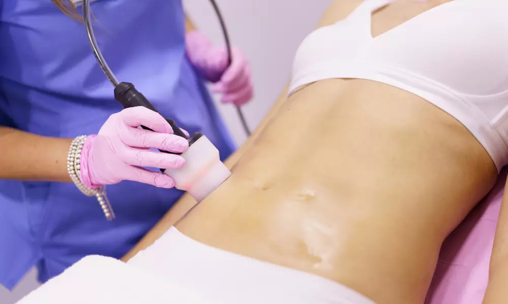 Up to ten sessions of fat cavitation or RF on one area at Miami Kiss