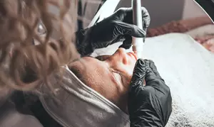 Aquafacial mit Microdermabrasion oder Glowstart Gesichtsbehandlung (bis zu 45% sparen)