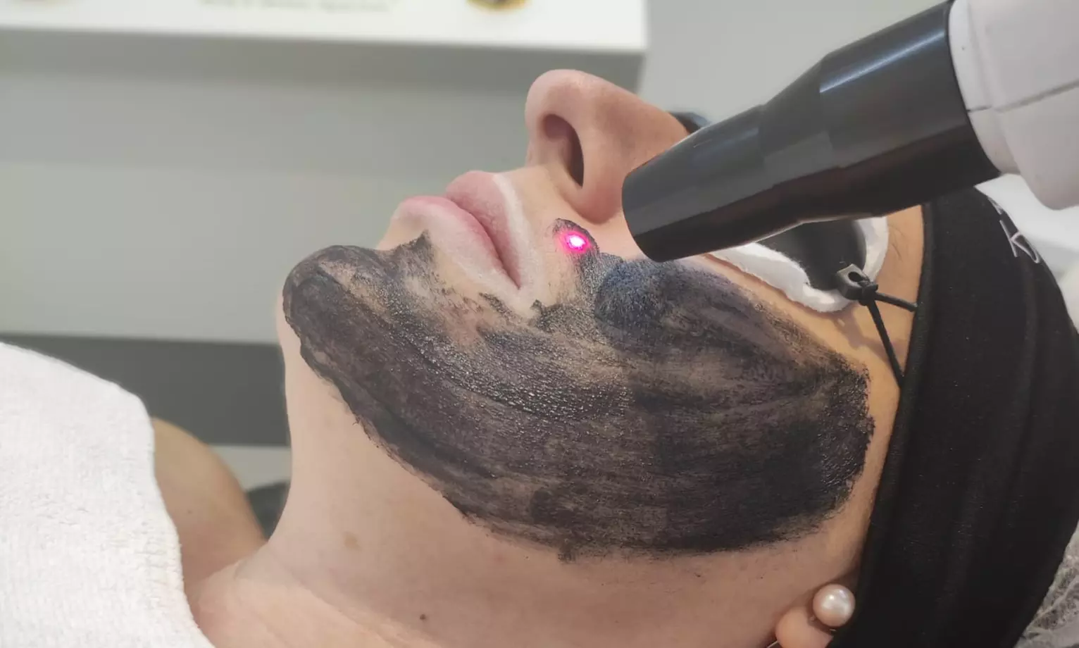 Tratamiento facial con láser en Sapphira Prive Madrid centro