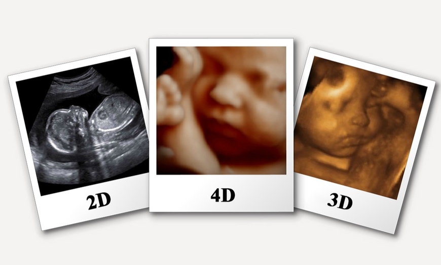 Image 1: Up to 25% Off on Ultrasound at Baby Scanning Boutique