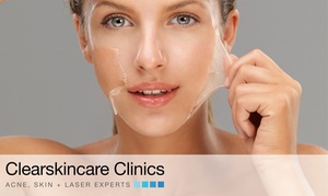 Skin Peel Facial Pkg, 46 Locations