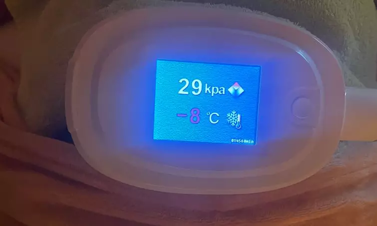 Séance de cryolipolyse "perte de cm par le froid"