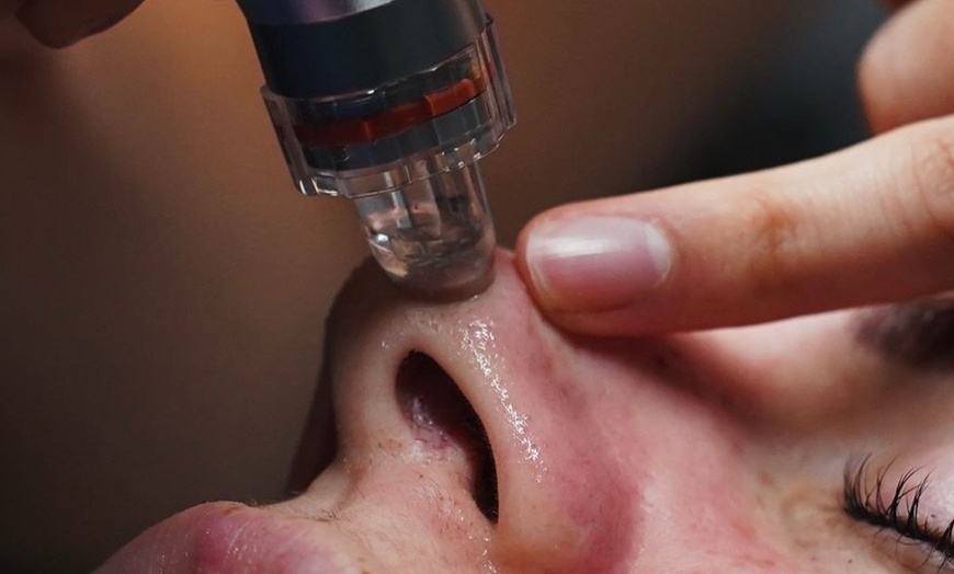 Image 2: Experience One or Two Sessions of Hydra Facial and Unleash Your Glow