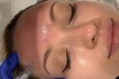 Unlock Skin Transformation with One Micro-Needling Treatment at ART iBrow Threading Salon(Up to 30% Off)  - Second Medium