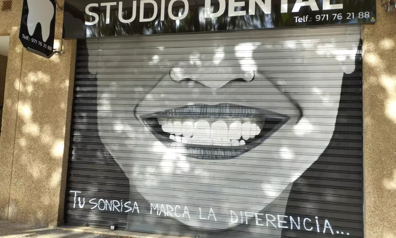 Limpieza bucal con ultrasonidos, radiografía, revisión y pulido