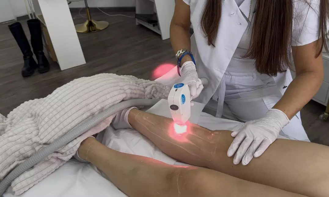 Endlich haarfrei:IPL mit SHR Modus od. 3 Wellen Diodenlaser Behandlung