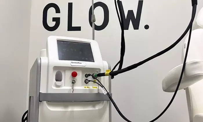 Six Laser Hair Removal Sessions of Your Chosen Area by Experts 