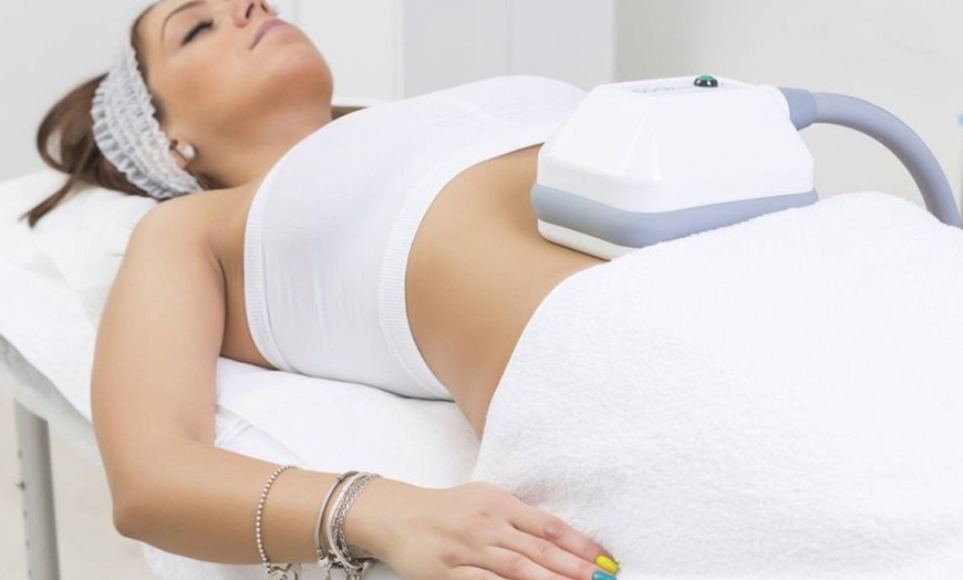 Image 3: One Session of Fat-Freezing Cryolipolysis at BM Aesthetics