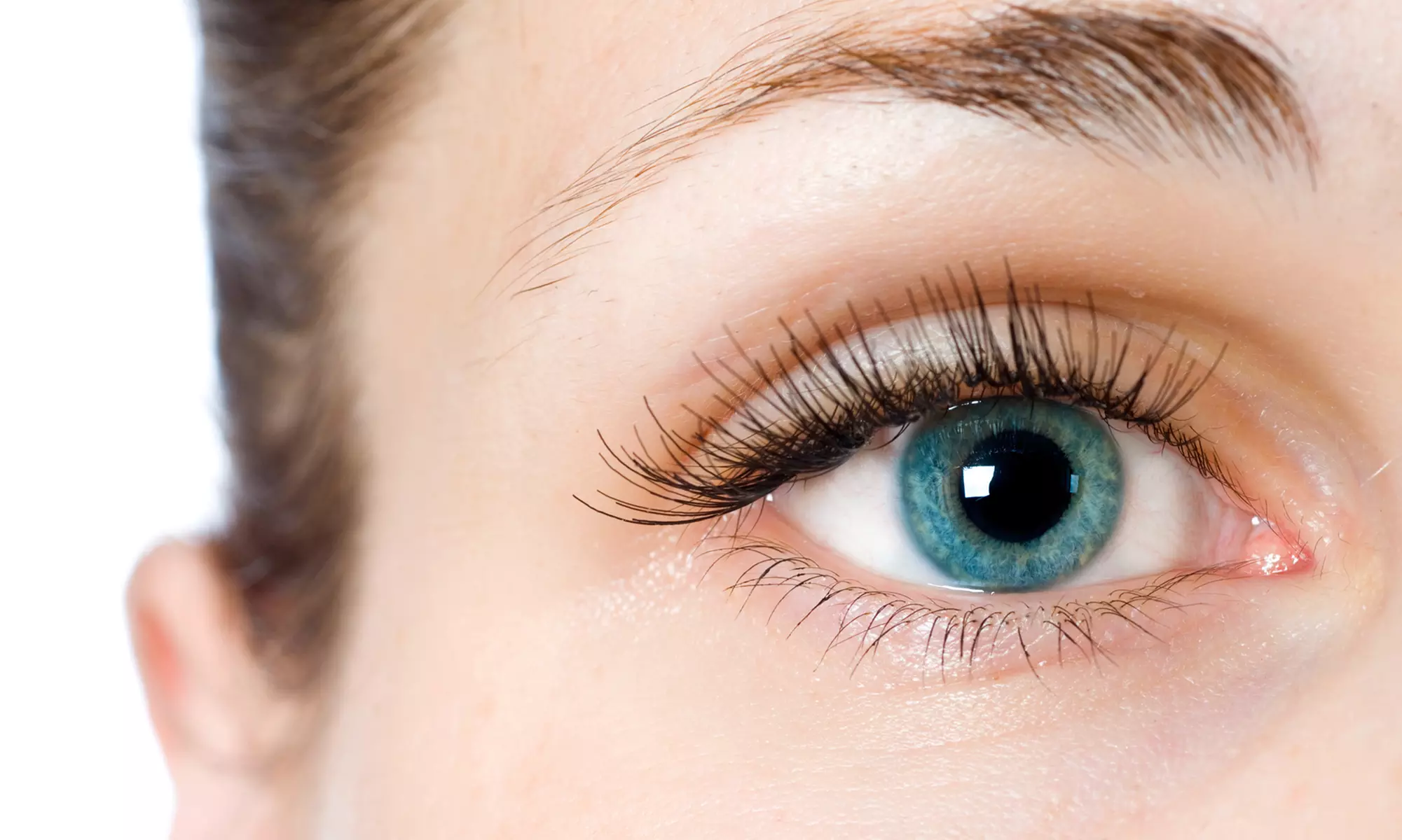 $3,499 for LASIK or PRK Laser Vision-Correction Surgery on Both Eyes at Carlsbad Eye Care ($5,500 Value)   - Primary Image