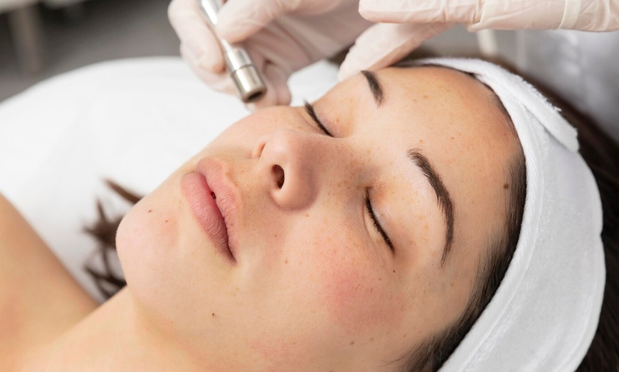 Image 1: Transform Your Skin: Super Hydrafacial & Diamond Microdermabrasion
